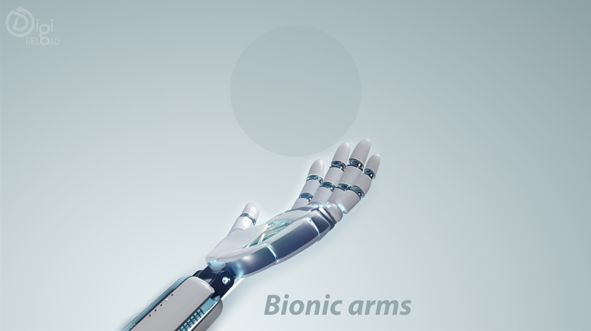Bionic arms